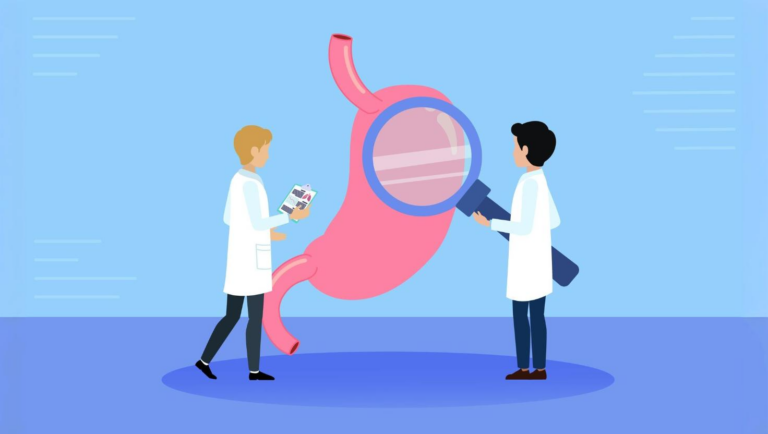 A Comprehensive Guide to Endoscopic Sleeve Gastroplasty (ESG)