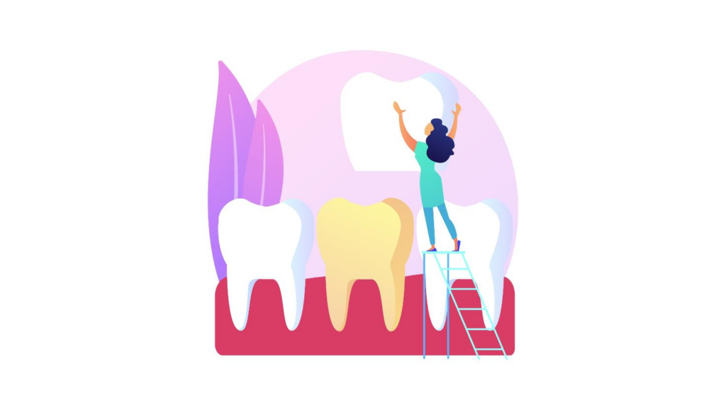 Dental Crowns Abroad: A Comprehensive Guide for Medical Tourists